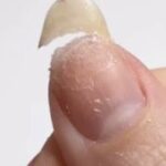 Réparation 1 ongle cassé